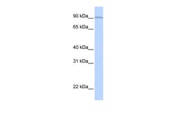 Aviva Systems Biology Corp AOC2 Antibody - middle region (ARP45057_P050)
