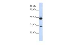 Aviva Systems Biology Corp FLT3LG Antibody - N-terminal region (ARP45110_P050)