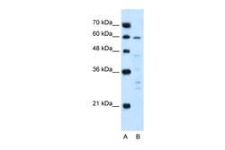 Aviva Systems Biology Corp IL10RA Antibody - N-terminal region (ARP45135_T100)