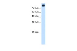 Aviva Systems Biology Corp CDH3 Antibody - N-terminal region (ARP45170_T100)