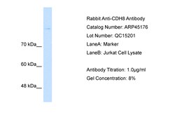 Aviva Systems Biology Corp CDH8 Antibody - middle region (ARP45176_P050)