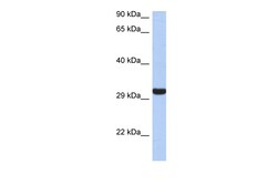 Aviva Systems Biology Corp GZMK Antibody - middle region (ARP45220_P050)