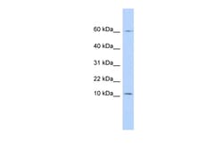 Aviva Systems Biology Corp PI3 Antibody - N-terminal region (ARP45340_P050)