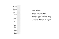 Aviva Systems Biology Corp PTPRN Antibody - middle region (ARP45381_P050)