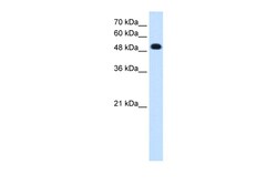 Aviva Systems Biology Corp PTPRR Antibody - C-terminal region (ARP45387_P050)
