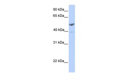 Aviva Systems Biology Corp ST3GAL1 Antibody - C-terminal region (ARP45410_P050)