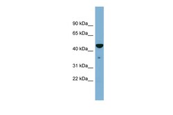 Aviva Systems Biology Corp TAPBP Antibody - middle region (ARP45438_P050)