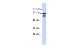 Aviva Systems Biology Corp GALNT4 Antibody - middle region (ARP45527_P050)