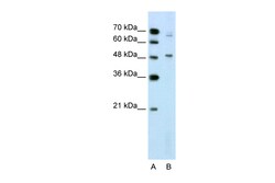 Aviva Systems Biology Corp NR0B1 Antibody - N-terminal region (ARP45597_T100)