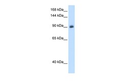 Aviva Systems Biology Corp NR3C2 Antibody - middle region (ARP45599_T100)