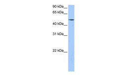 Aviva Systems Biology Corp ESRRG Antibody - N-terminal region (ARP45602_P050)