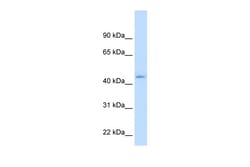 Aviva Systems Biology Corp NR1I3 Antibody - N-terminal region (ARP45623_T100)
