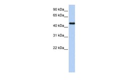 Aviva Systems Biology Corp NR2F1 Antibody - N-terminal region (ARP45628_P050)