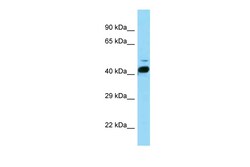 Aviva Systems Biology Corp Rorb Antibody - N-terminal region (ARP45630_P050)