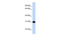 Aviva Systems Biology Corp NR0B2 Antibody - N-terminal region (ARP45635_P050)