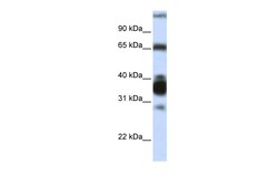 Aviva Systems Biology Corp ARG1 Antibody - N-terminal region (ARP45671_P050)