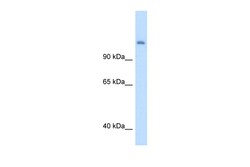 Aviva Systems Biology Corp CPS1 Antibody - middle region (ARP45690_T100)