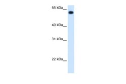Aviva Systems Biology Corp ALDH4A1 Antibody - C-terminal region (ARP45697_T100)