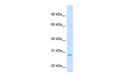 Aviva Systems Biology Corp ECHS1 Antibody - middle region (ARP45699_T100)