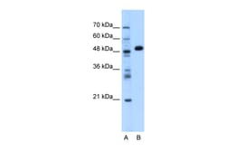 Aviva Systems Biology Corp GPT Antibody - N-terminal region (ARP45712_T100)