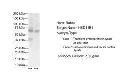 Aviva Systems Biology Corp HSD11B1 Antibody - N-terminal region (ARP45714_P050)