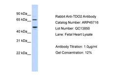 Aviva Systems Biology Corp TDO2 Antibody - N-terminal region (ARP45716_P050)