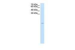 Aviva Systems Biology Corp SOD1 Antibody - N-terminal region (ARP45752_T100)