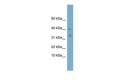 Aviva Systems Biology Corp NDUFV3 Antibody - middle region (ARP45758_P050)