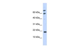 Aviva Systems Biology Corp C21orf87 Antibody - C-terminal region (ARP45782_P050)