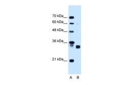 Aviva Systems Biology Corp CBR1 Antibody - C-terminal region (ARP45801_T100)