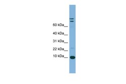 Aviva Systems Biology Corp TFF1 Antibody - middle region (ARP45808_P050)