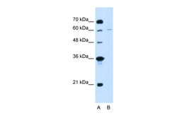 Aviva Systems Biology Corp CHAF1B Antibody - C-terminal region (ARP45827_T100)