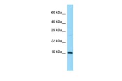 Aviva Systems Biology Corp Sumo3 Antibody - N-terminal region (ARP45841_P050)
