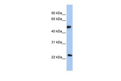 Aviva Systems Biology Corp POFUT2 Antibody - N-terminal region (ARP45855_P050)