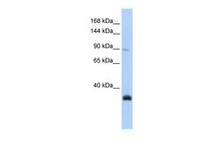 Aviva Systems Biology Corp MORC3 Antibody - N-terminal region (ARP45856_P050)