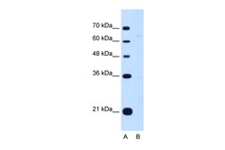 Aviva Systems Biology Corp DONSON Antibody - middle region (ARP45862_P050)