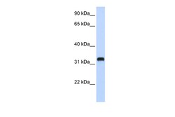 Aviva Systems Biology Corp C21orf62 Antibody - middle region (ARP45868_P050)