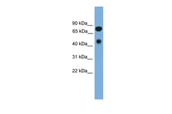 Aviva Systems Biology Corp RIPK4 Antibody - N-terminal region (ARP45871_P050)