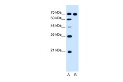 Aviva Systems Biology Corp RRM1 Antibody - C-terminal region (ARP46029_T100)