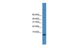 Aviva Systems Biology Corp PCLAF Antibody - N-terminal region (ARP46033_P050)