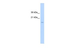 Aviva Systems Biology Corp CENPA Antibody - N-terminal region (ARP46040_T100)