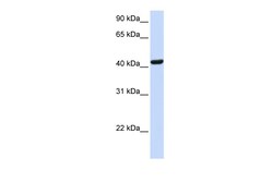 Aviva Systems Biology Corp SKAP1 Antibody - N-terminal region (ARP46047_P050)