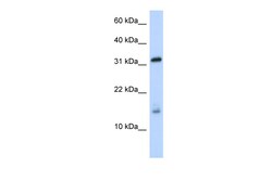 Aviva Systems Biology Corp EIF1AX Antibody - middle region (ARP46055_P050)