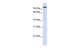 Aviva Systems Biology Corp HSPA4 Antibody - middle region (ARP46074_P050)