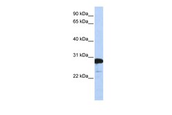 Aviva Systems Biology Corp RANBP1 Antibody - C-terminal region (ARP46083_P050)