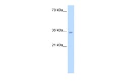 Aviva Systems Biology Corp ATIC Antibody - middle region (ARP46094_T100)