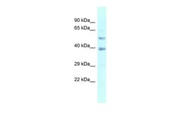 Aviva Systems Biology Corp FEN1 Antibody - N-terminal region (ARP46096_P050)