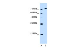 Aviva Systems Biology Corp NOLC1 Antibody - C-terminal region (ARP46110_T100)