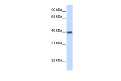 Aviva Systems Biology Corp MAGEA1 Antibody - N-terminal region (ARP46115_P050)