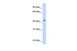 Aviva Systems Biology Corp MAGEA1 Antibody - C-terminal region (ARP46116_T100)